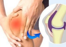 如何预防膝关节骨质增生？
