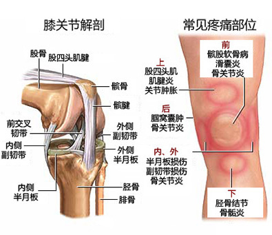 膝关节炎